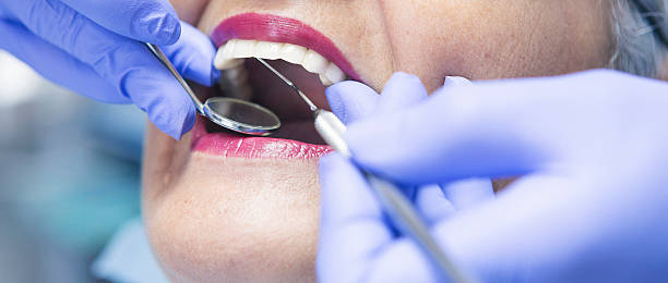Best Emergency Dentist for Lost Fillings or Crowns in Suffern, NY